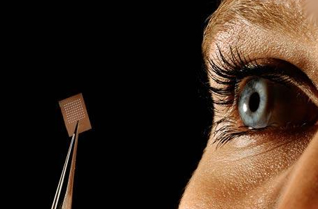 Симптомы, причины и лечение отслоения сетчатки глаза